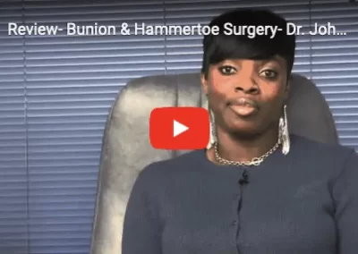 Bunion & Hammertoe Surgery Review NYC - Foot Doctor