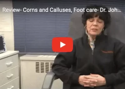 Corns & Calluses Review NYC - Foot Doctor